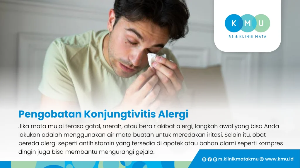 Pengobatan Konjungtivitis Alergi