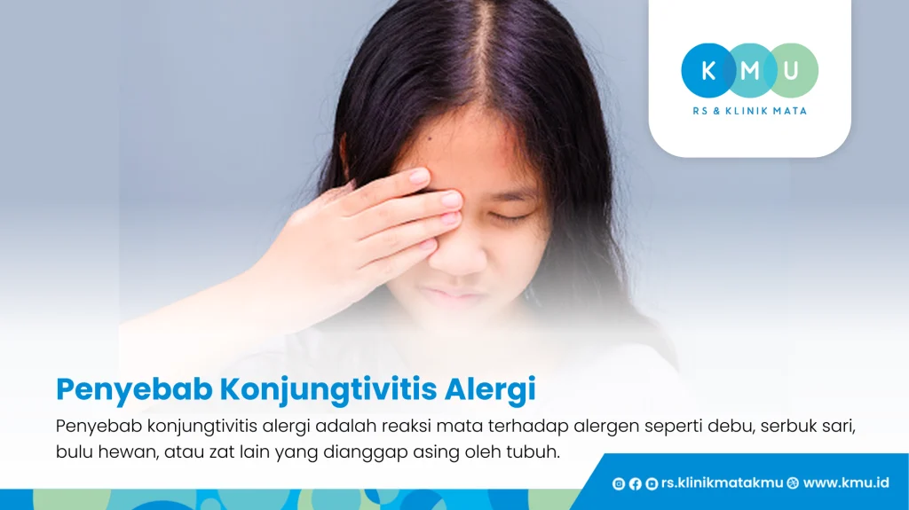 Penyebab Konjungtivitis Alergi