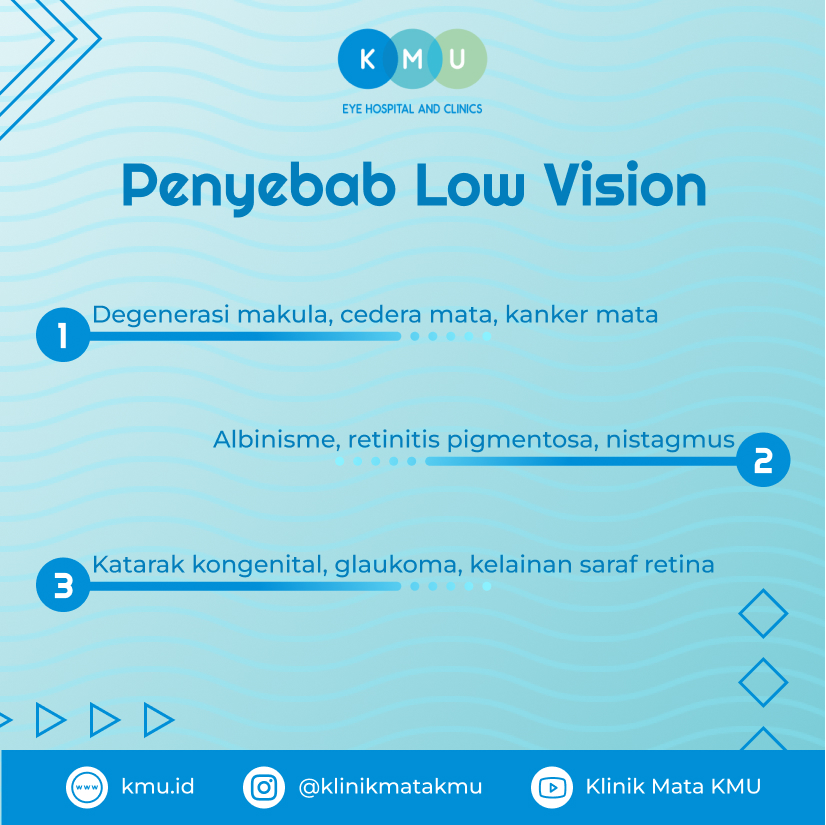 Penyebab Low Vision