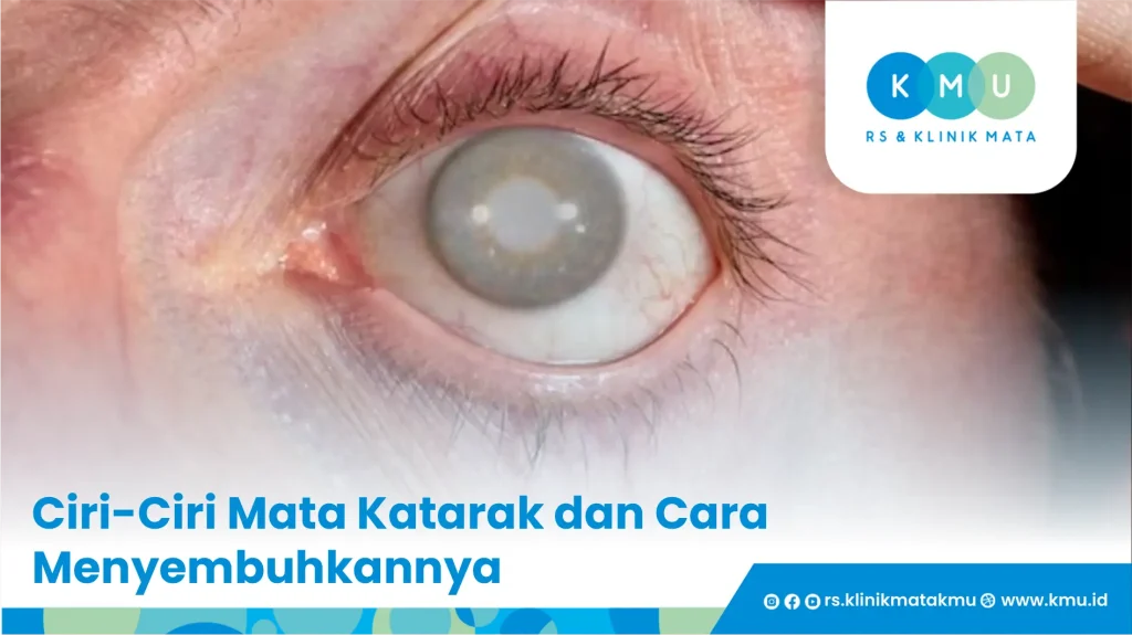 Ciri-ciri mata Katarak