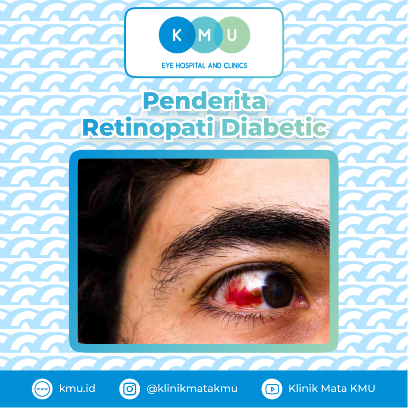 Penglihatan Orang Dengan Penyakit Mata Retinopati DIabetic