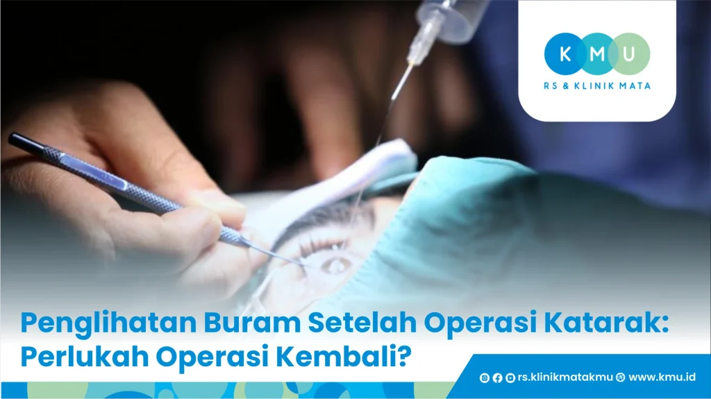 Penglihatan buram setelah operasi Katarak