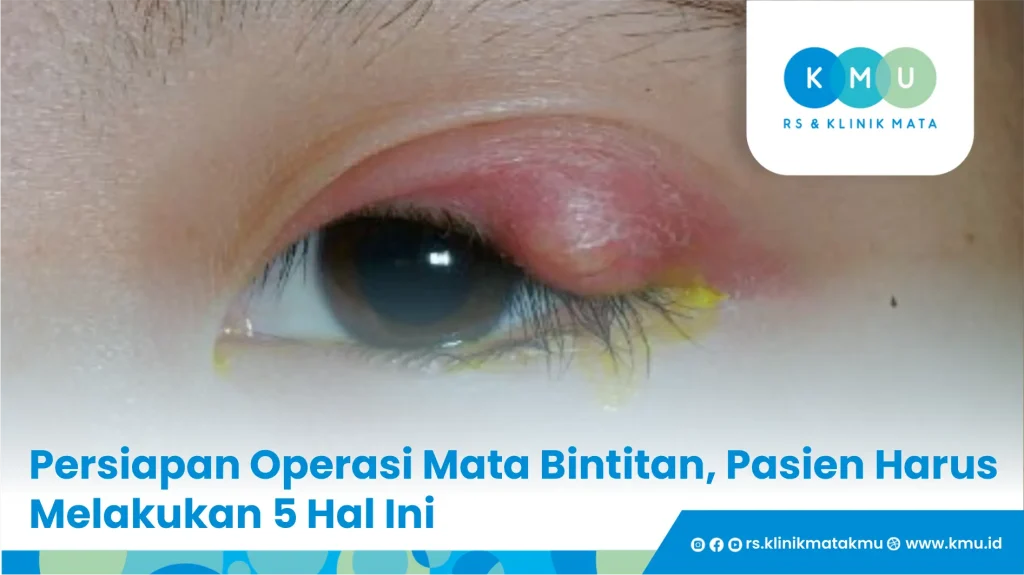 Persiapan-operasi-mata-bintitan