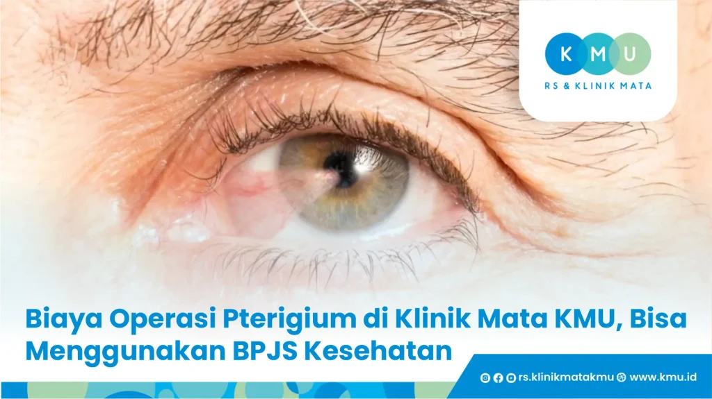 biaya operasi pterigium
