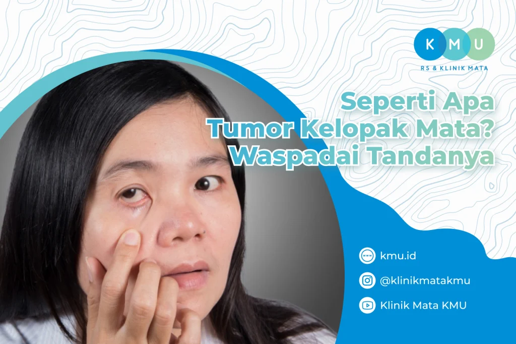 Tumor Kelopak Mata, Waspadai Akibatnya