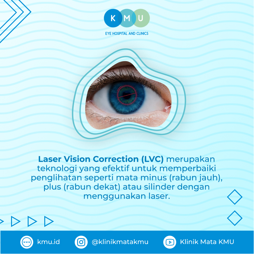 Laser Vision Correction_Zeiss Smile