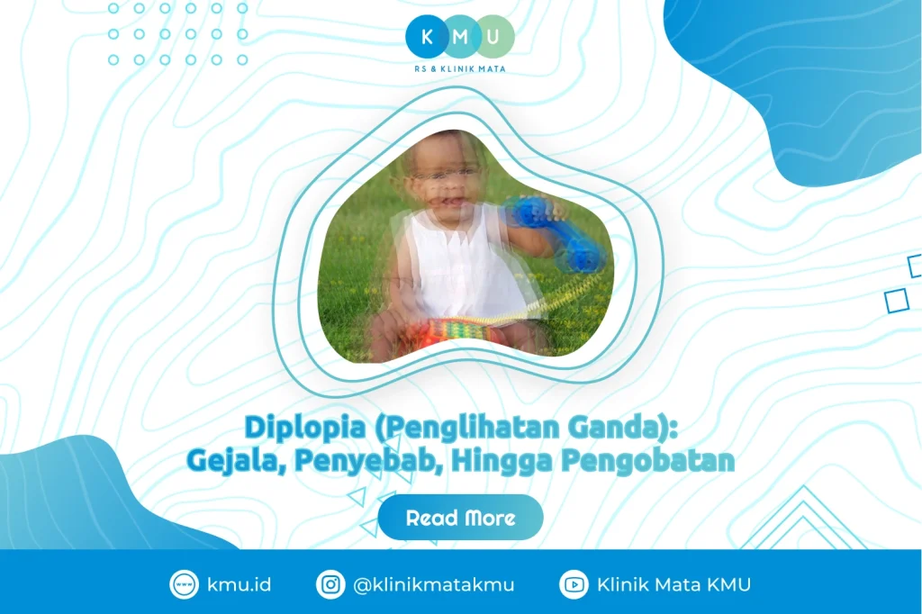 Diplopia (Penglihatan Ganda)