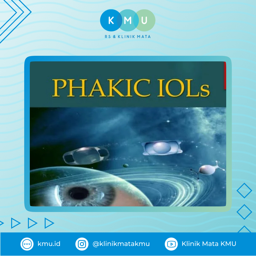 Phakic IOLs - Lasik di Surabaya