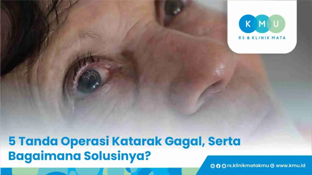 5 Tanda Operasi Katarak Gagal, Serta Bagaimana Solusinya?