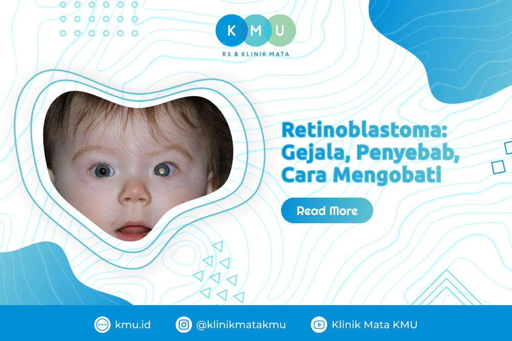 Retinoblastoma: Gejala, Penyebab, Cara Mengobati