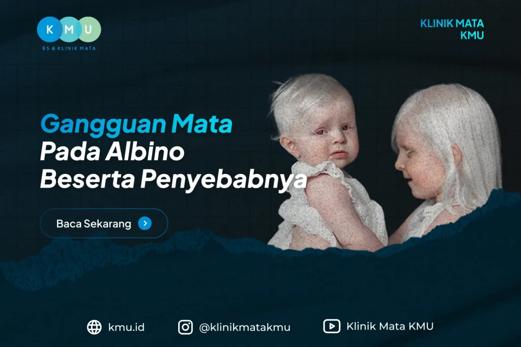 Gangguan Mata Pada Albino