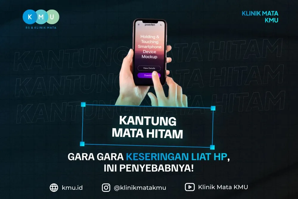 Kantung Mata Hitam Terlalu Sering Menatap HP? Ini Penyebabnya!