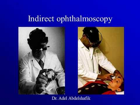oftalmoskopi