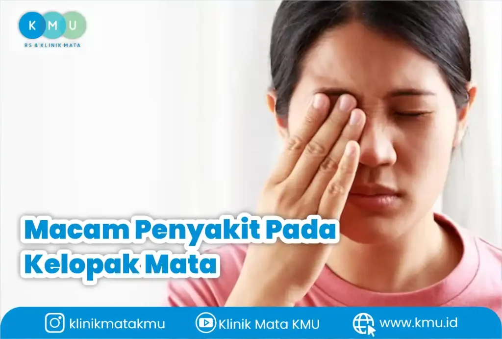Penyakit Di Kelopak Mata