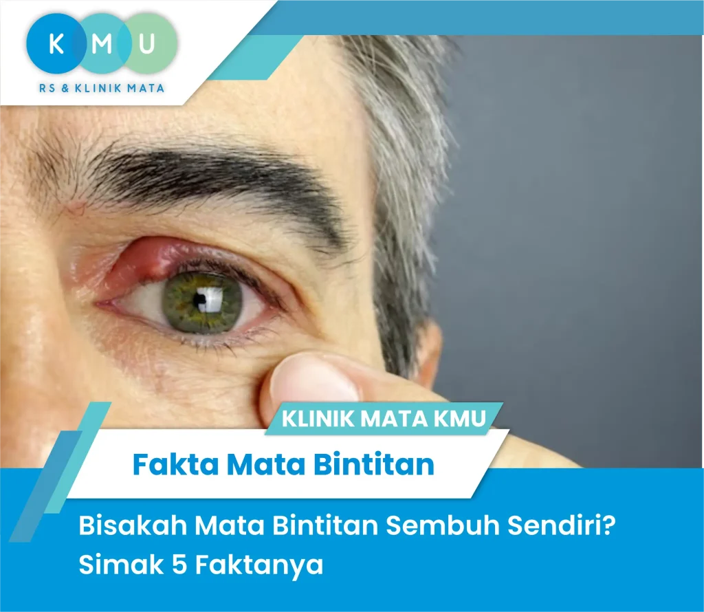 Mata bintitan sembuh
