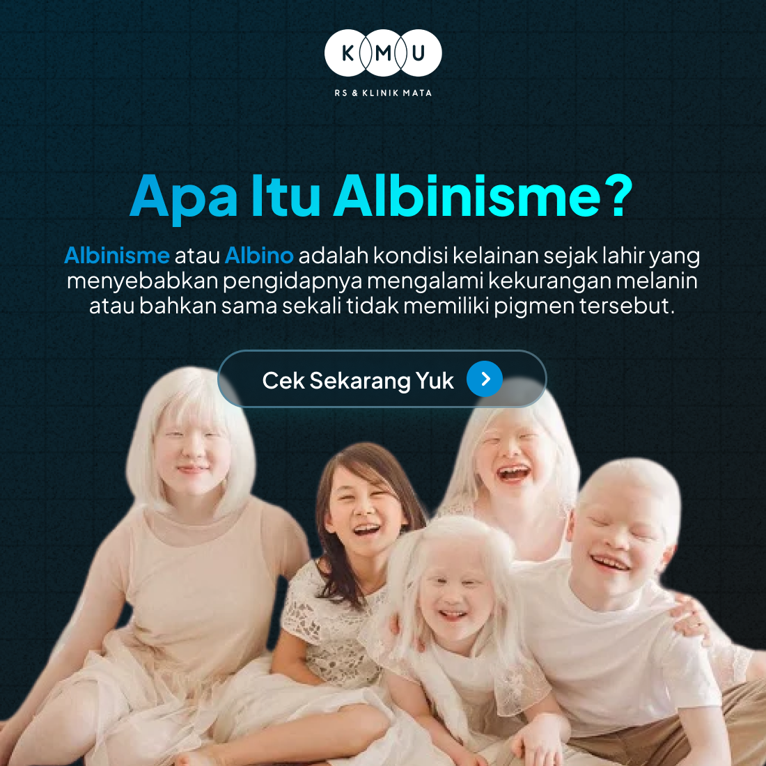 Apa Itu Albinisme - Gangguan mata pada albino