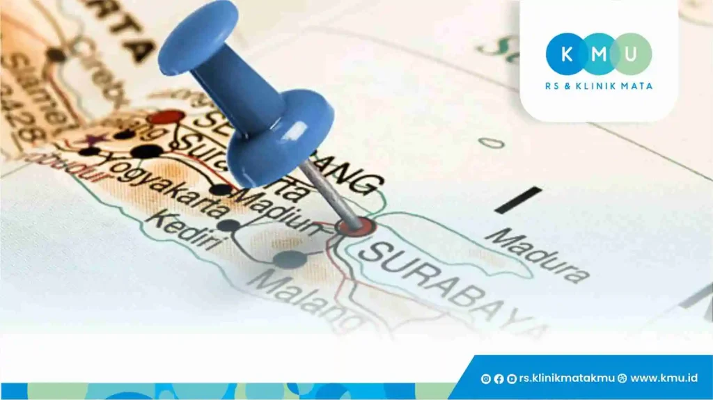 Biaya Operasi Katarak di Jawa Timur 2026