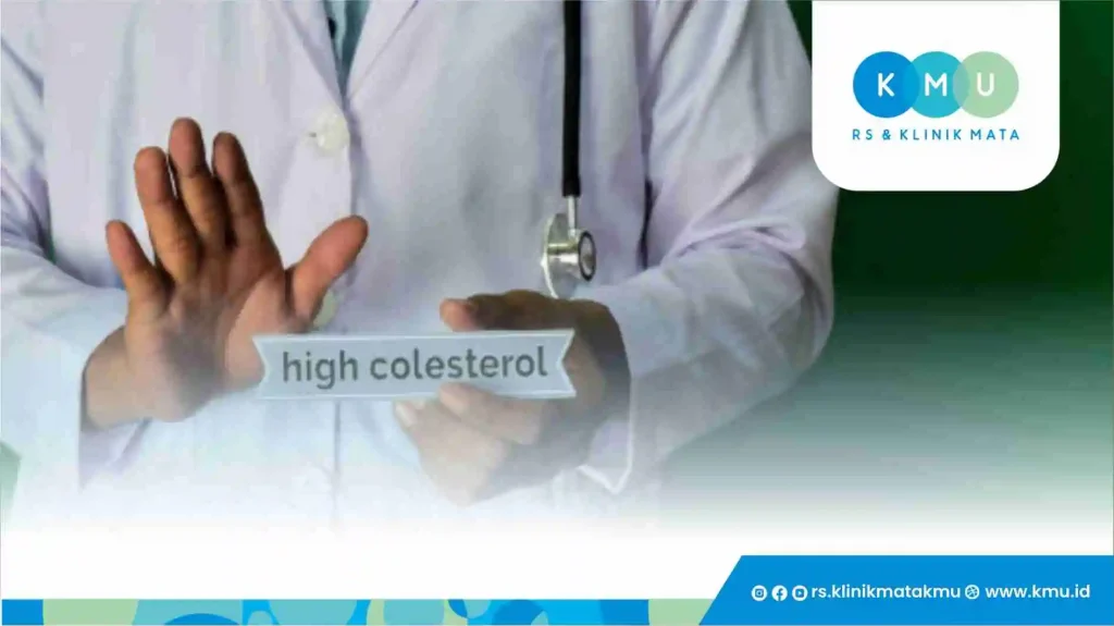 Benarkah Kolesterol Tinggi Dapat Menyebabkan Gangguan Mata?