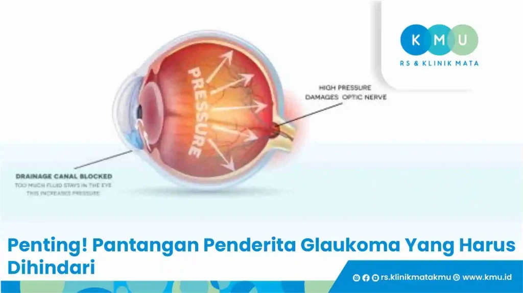 Penting! Pantangan Penderita Glaukoma Yang Harus Dihindari