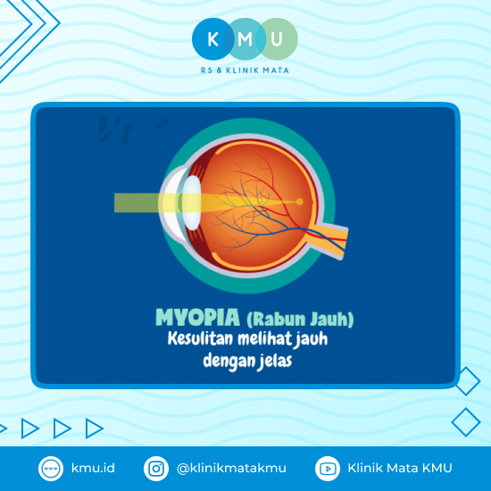 Myopia (Rabun Jauh) - Apakah Mata Minus Bisa Sembuh?