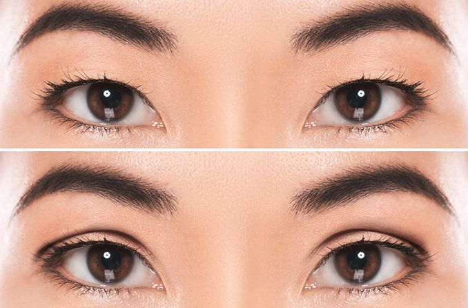 jenis kelopak mata: monolid dan double eyelid