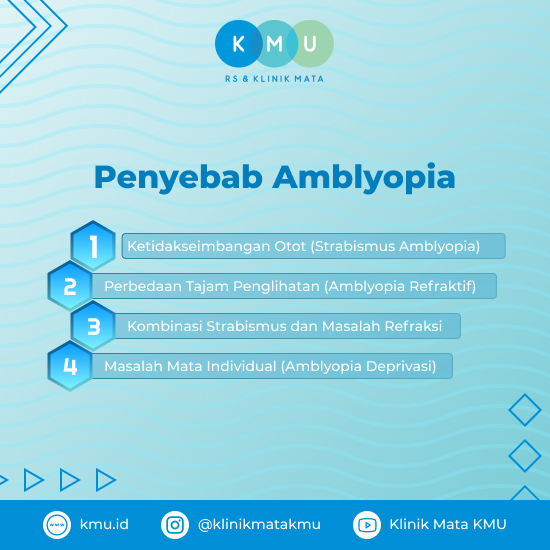 Penyebab Amblyopia