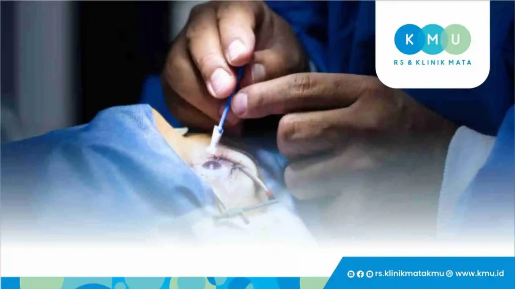 Pendapat Ulama Tentang Operasi Mata