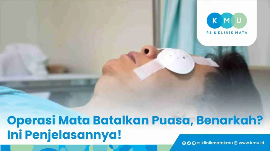 Operasi Mata Batalkan Puasa, Benarkah? Ini Penjelasannya!