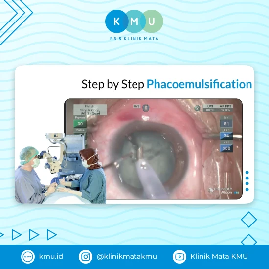 Operasi Phacoemulsification
