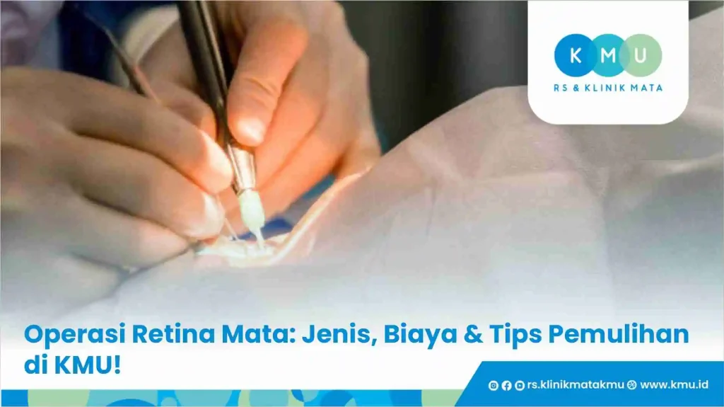 Operasi Retina Mata: Jenis, Biaya & Tips Pemulihan di KMU!
