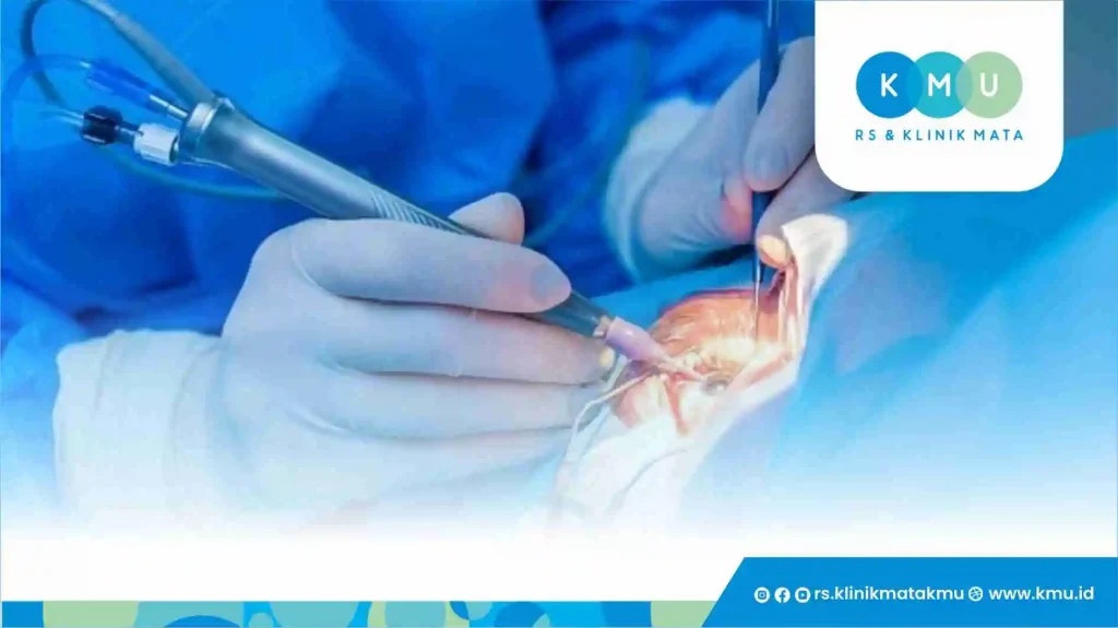 Jenis Operasi Retina Mata di KMU