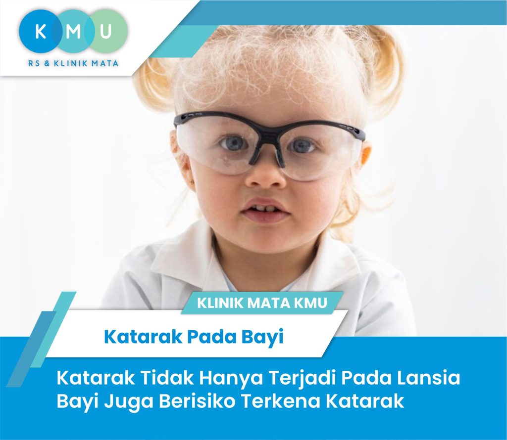 Katarak pada bayi