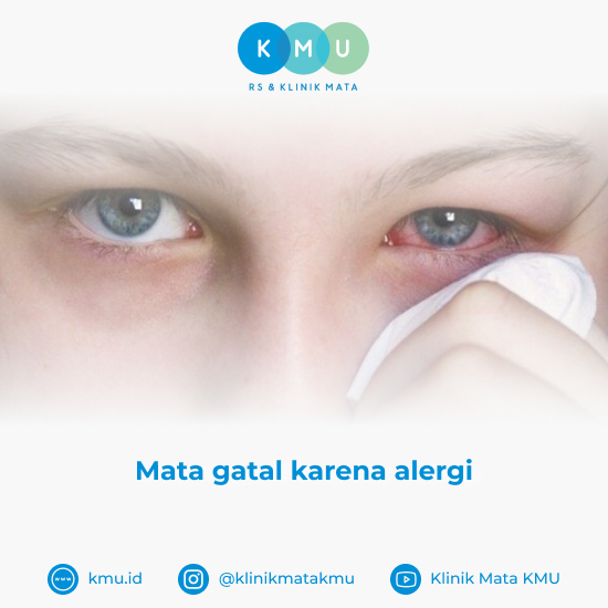Obat Mata Gatal Karena Alergi