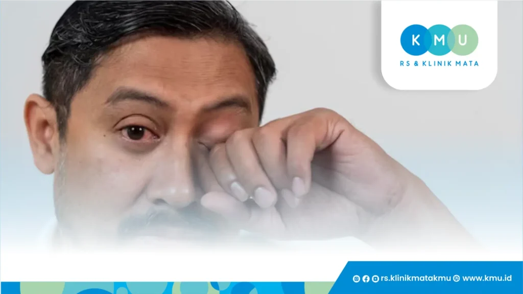 Mata Bengkak Dan Gatal