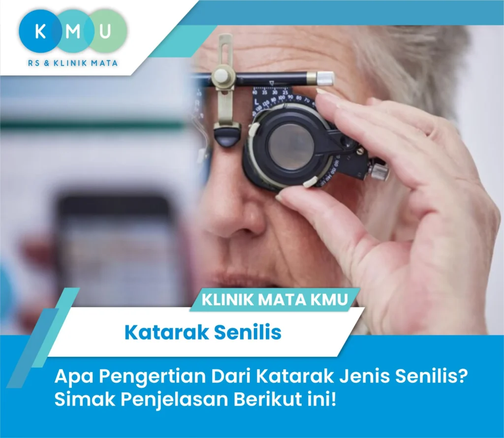 Katarak Senilis