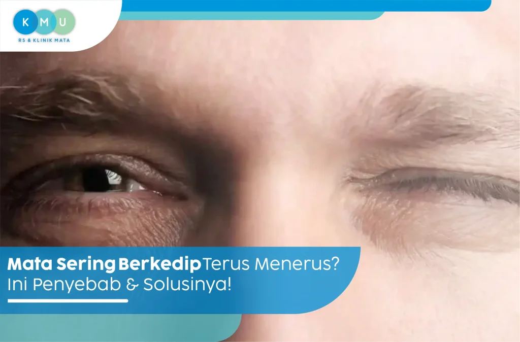 Mata Sering Berkedip