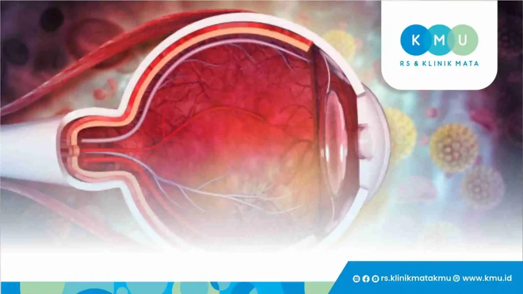Apa Itu Retina Mata?