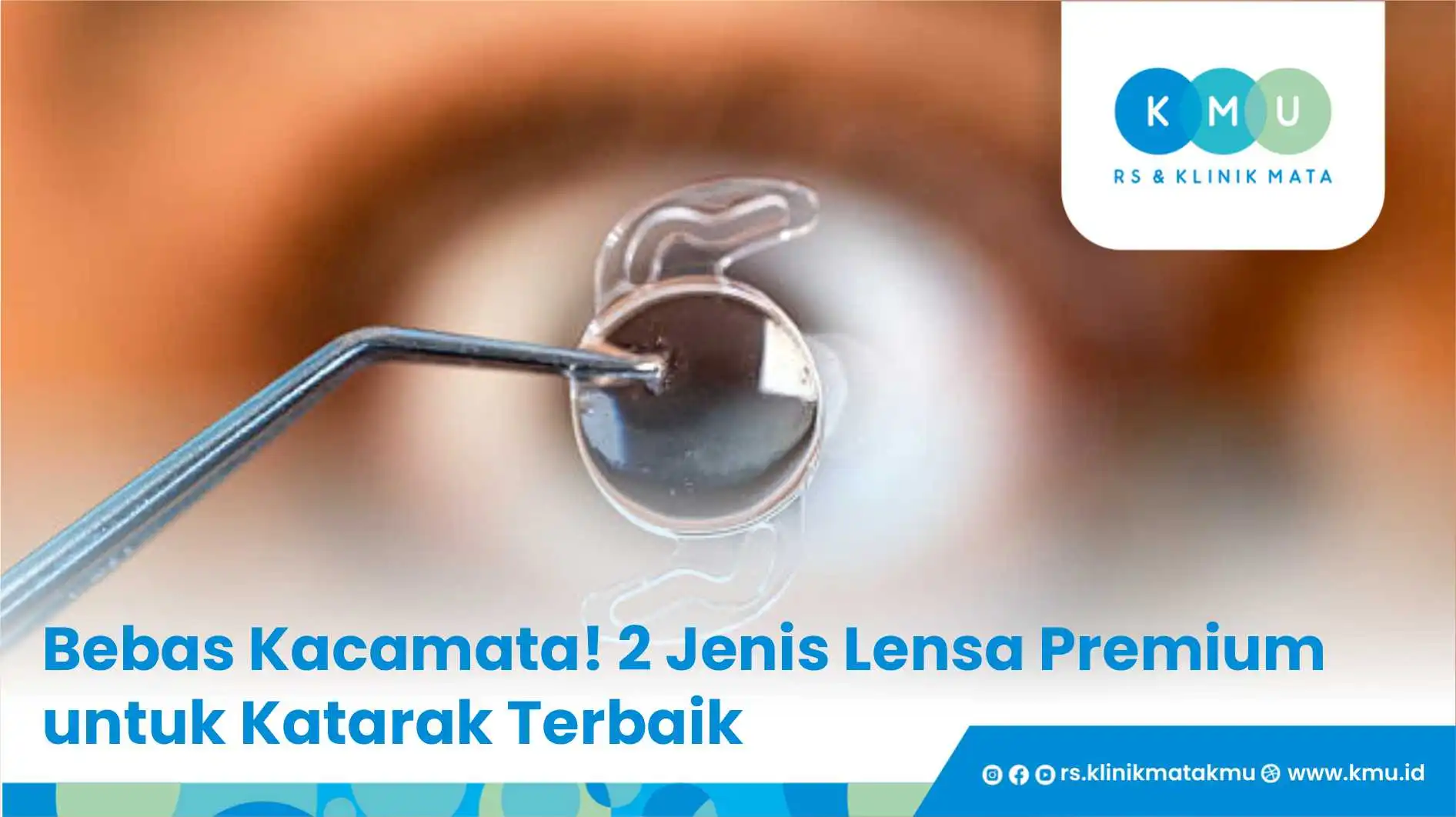 Bebas Kacamata! 2 Jenis Lensa Premium untuk Katarak Terbaik