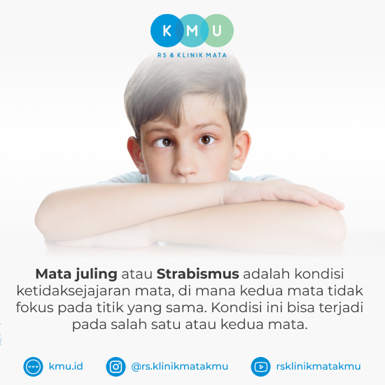 Pengertian Mata Juling