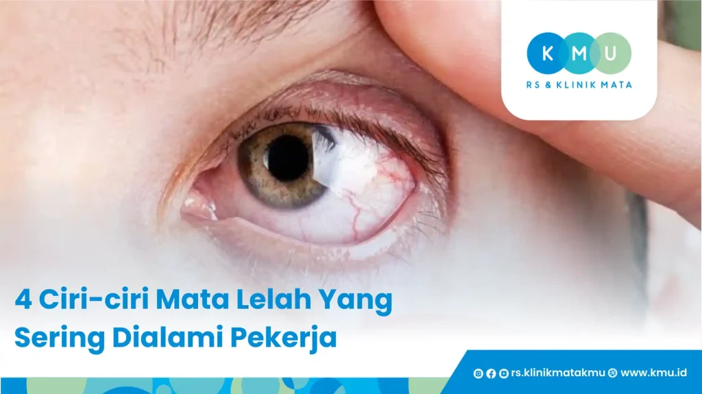 4 Ciri-ciri Mata Lelah Yang Sering Dialami Oleh Pekerja