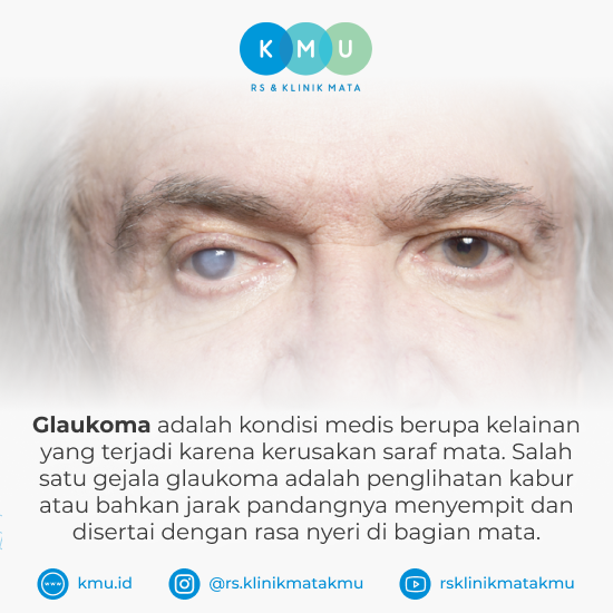 Apa Itu Glaukoma