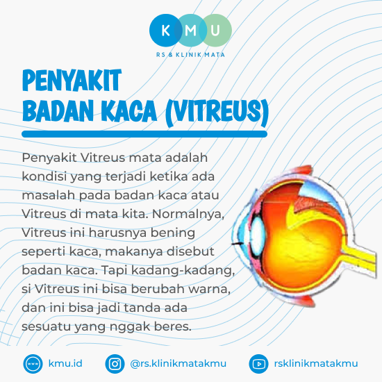 Penyakit Badan Kaca (Vitreus)