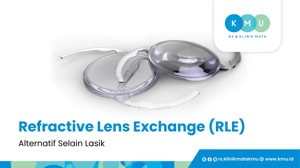 Refractive Lens Exchange (RLE) Sebagai Alternatif Lasik