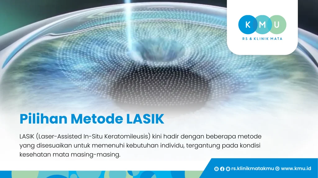 LASIK dan Metode Pilihannya - Dokter LASIK