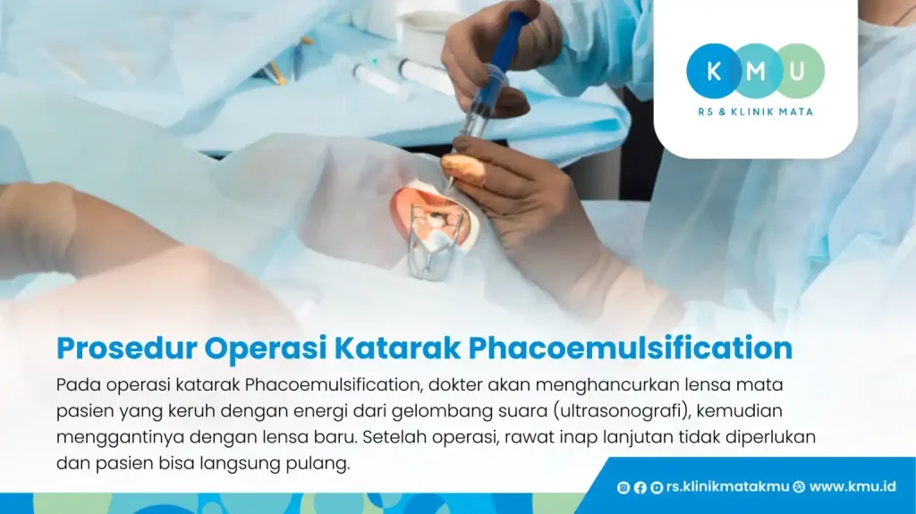 Prosedur Operasi Katarak Phacoemulsification