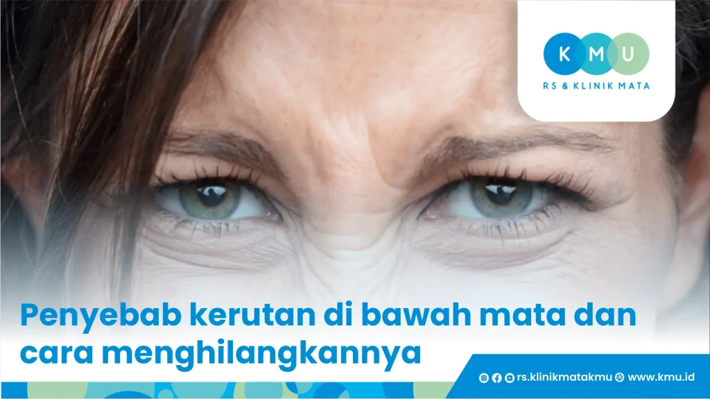 Penyebab kerutan di bawah mata dan cara menghilangkannya