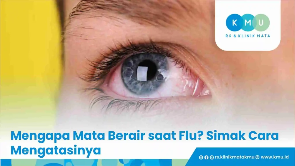 Mengapa Mata Berair saat Flu? Simak Cara Mengatasinya