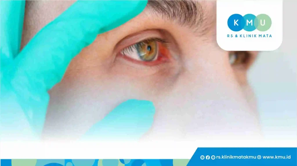 Kapan Harus Konsultasi Dengan Dokter Mata?ย