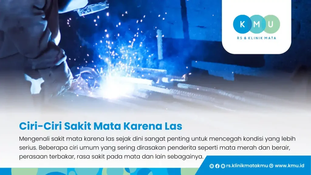 Ciri-Ciri Sakit Mata Karena Las