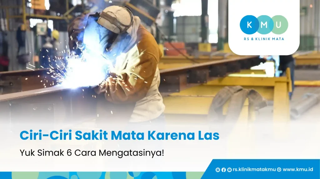 Ciri-Ciri Sakit Mata Karena Las dan 6 Cara Mengatasinya